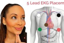 Understanding 5 Lead EKG Placement: A Practical Guide for Biomedical Professionals