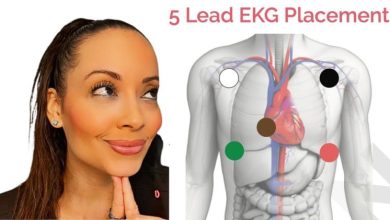Understanding 5 Lead EKG Placement: A Practical Guide for Biomedical Professionals